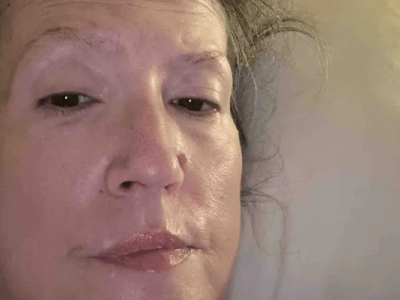 Urgent surgery and recovery